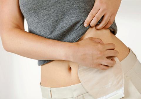 Dia Nacional dos Ostomizados é celebrado com ação social em Manaus