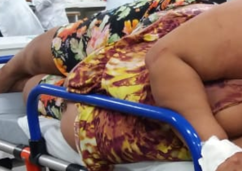 Grávida passa por procedimentos de emergência para não perder bebê em Manaus