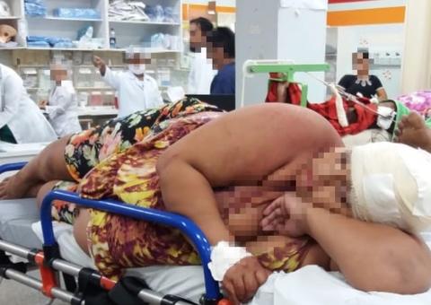 Grávida ferida em chacina está com bala alojada na cabeça em hospital de Manaus