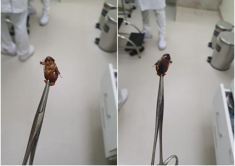 Barata ainda viva é retirada de ouvido de mulher 