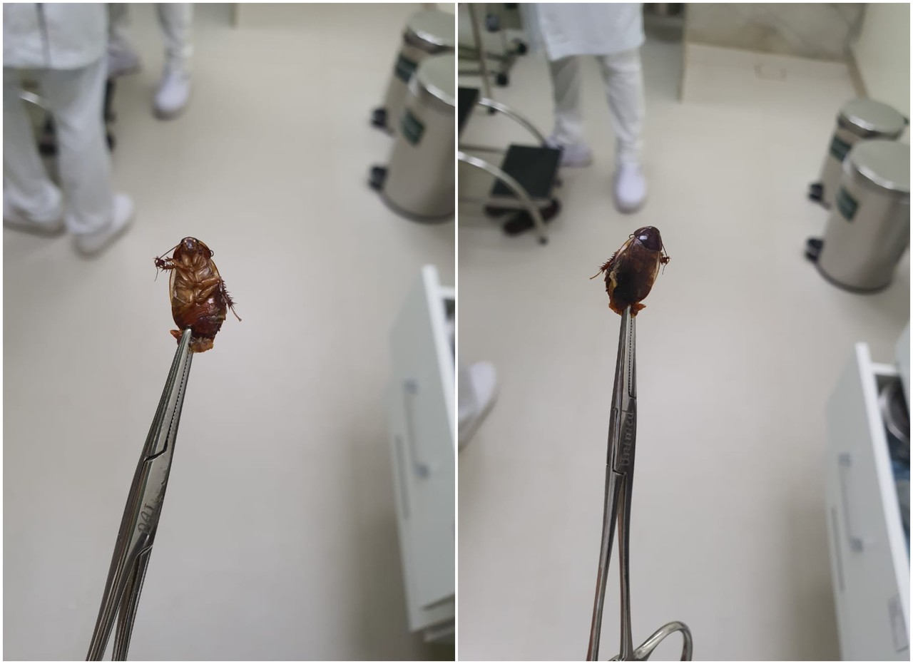 Barata ainda viva é retirada de ouvido de mulher 