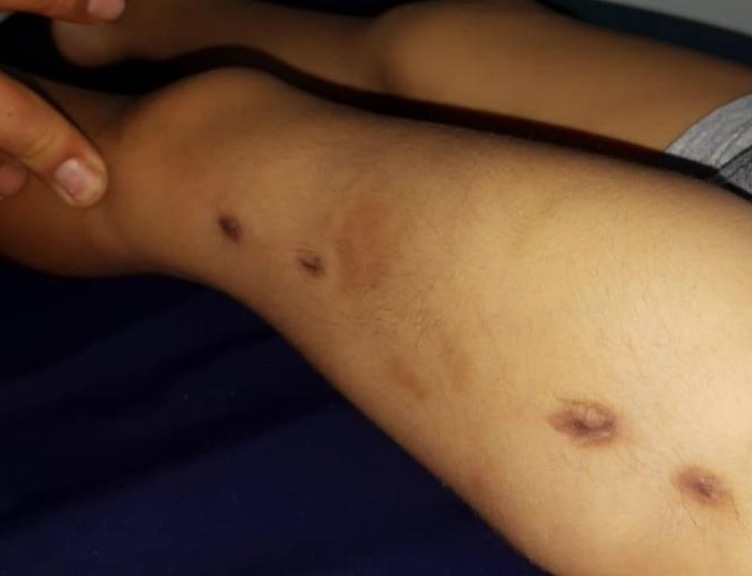 Mãe e companheira são presas suspeitas de espancar bebê até a morte