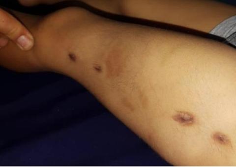 Mãe e companheira são presas suspeitas de espancar bebê até a morte