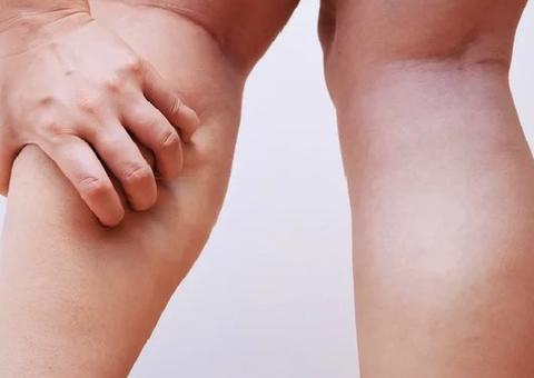 Cãibra na perna durante a noite: como parar e como prevenir