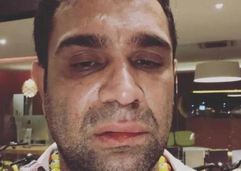 Humorista Evandro Santo pede R$ 60 mil de indenização por agressão