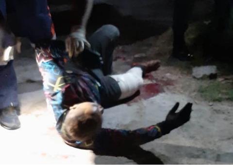 Com sete tiros, mototaxista é baleado em tentativa de assalto em Manaus