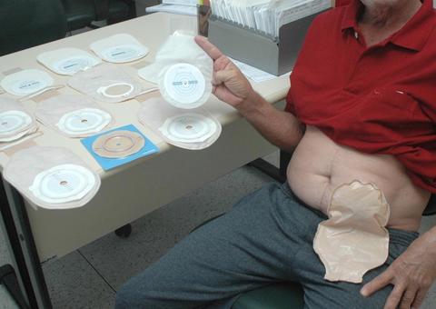 MPs ajuizam ação para garantir dignidade aos pacientes ostomizados do Amazonas 