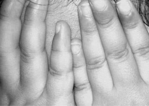 Casal é preso por agredir filho adotivo; criança está na UTI