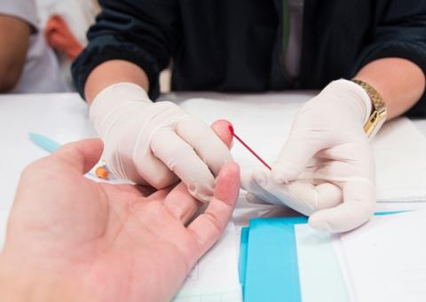 Em Manaus, Tropical realiza Dia de Testagem para HIV em horário especial nesta terça