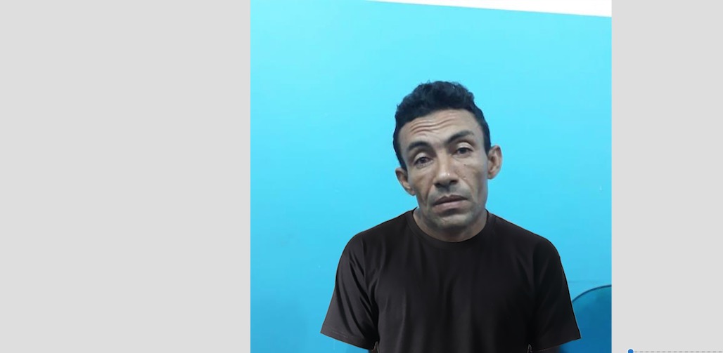 No Amazonas, homem é preso suspeito de queimar esposa no fogão