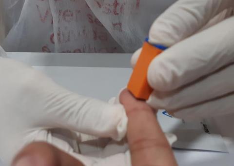 Dezembro Vermelho: Fundação Tropical realiza 323 testes rápidos de HIV em dois dias