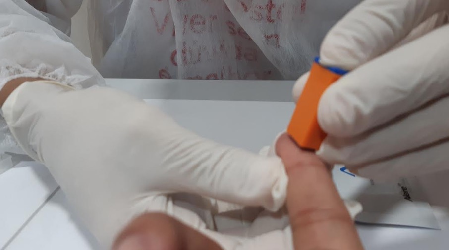 Dezembro Vermelho: Fundação Tropical realiza 323 testes rápidos de HIV em dois dias