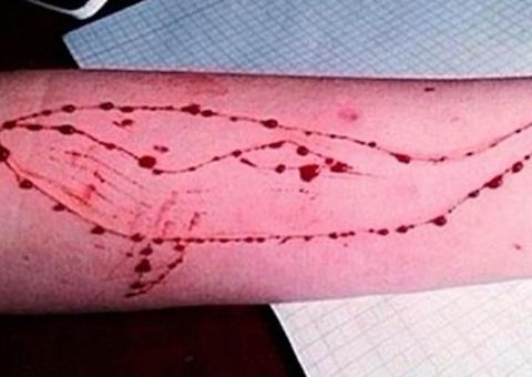 Senado aprova lei que criminaliza desafios que levam à automutilação