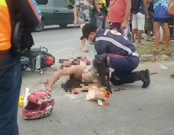 Homem tem dedos decepados em acidente gravíssimo com motocicleta em Manaus
