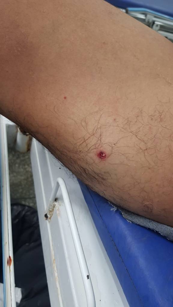 Mulher morre e marido fica ferido após ataque de piratas no Amazonas 