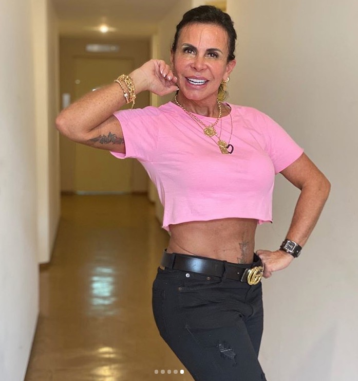 Umbigo de Gretchen desaparece após lipoaspiração e internautas ficam chocados 