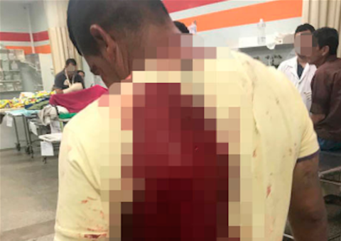 Passageiro é esfaqueado durante assalto a ônibus em Manaus