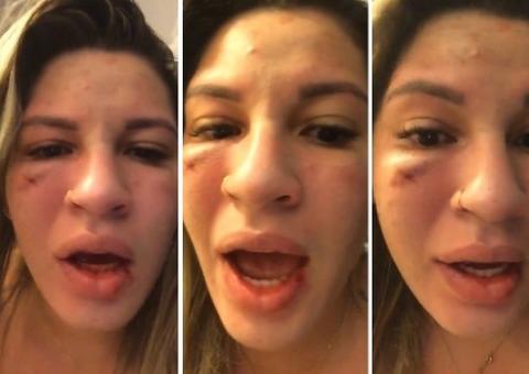 Esposa de Jean, do São Paulo diz que foi agredida por goleiro: 'Quero justiça' 