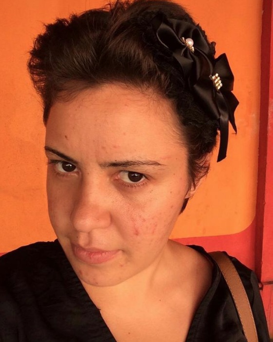 Mulher com transtornos mentais desaparece em Manaus e família pede ajuda