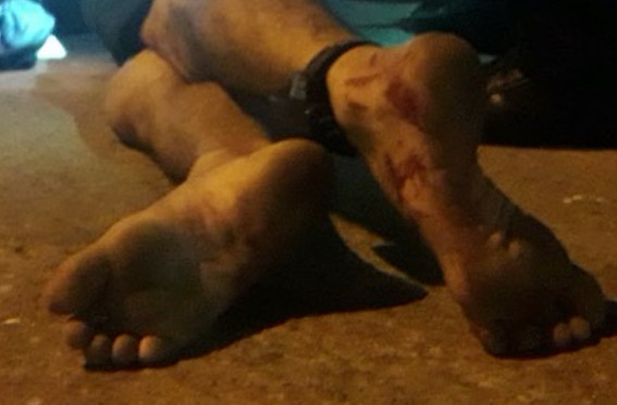 Detento do semiaberto é perseguido e executado em Manaus