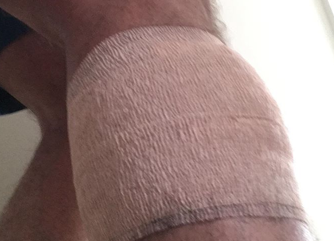 Alex Escobar sofre grave acidente doméstico: ‘Abriu uma fenda na minha perna'