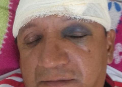 Em Manaus, vizinho irado invade loja e espanca dono com barra de ferro na frente dos filhos