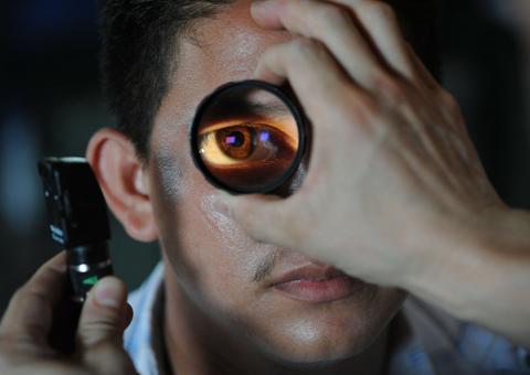 Visita ao oftalmologista pode prevenir câncer nos olhos