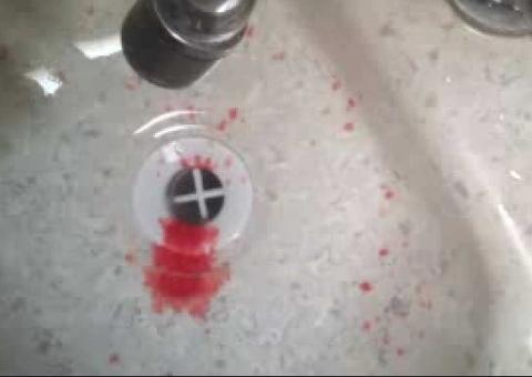 Com ciúmes, homem quebra nariz de companheira com uma mesa na virada do ano