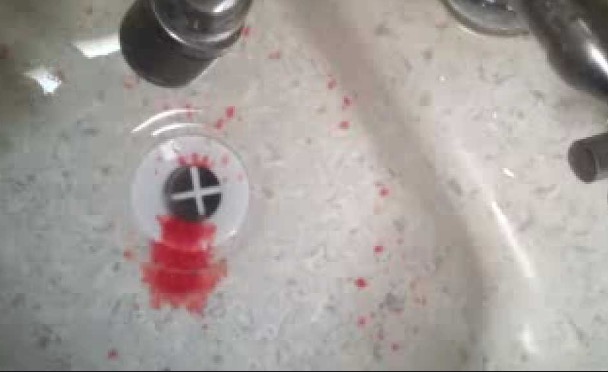 Com ciúmes, homem quebra nariz de companheira com uma mesa na virada do ano