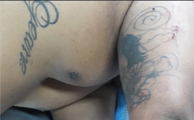 Homem sai para comprar leite para filho e é baleado em Manaus