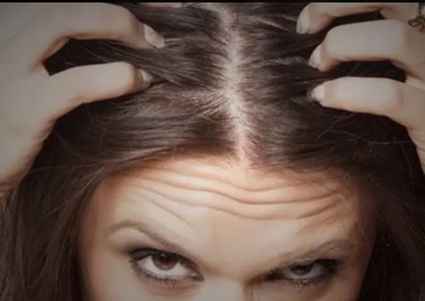 Veja mitos e verdades sobre queda de cabelo e fique atento