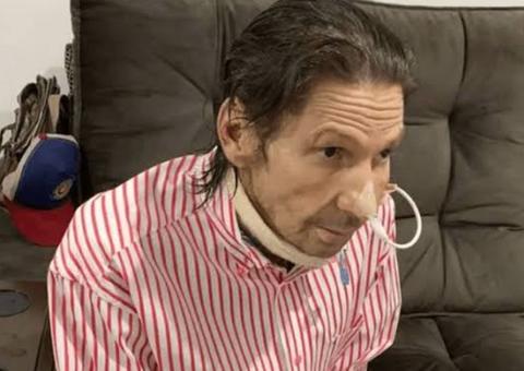 Asa Branca volta a ser internado com falta de ar e pressão baixa