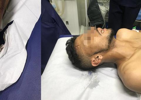 Suspeito de arrastão é baleado ao trocar tiros com a polícia em Manaus 