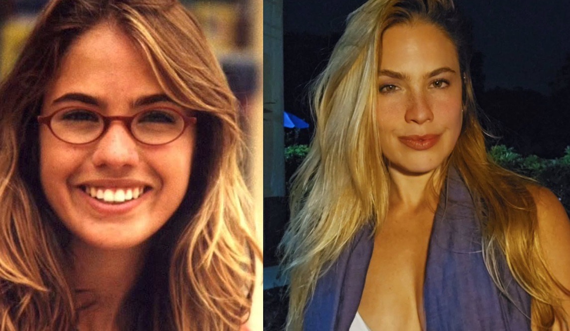 Ex-Malhação revela ter perdido a visão após ser agredida por ex-namorado