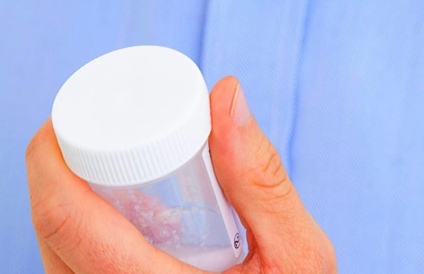 Presença de sangue no esperma pode ser causada por infecção na próstata