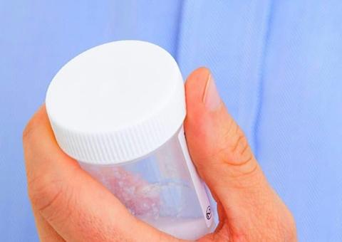 Presença de sangue no esperma pode ser causada por infecção na próstata