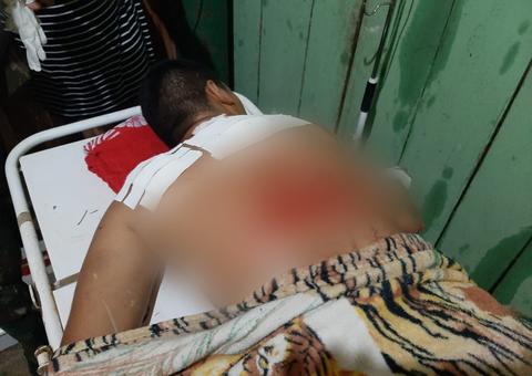  Durante confronto, cabo do Exército cai em rio e tem costas dilaceradas por hélice de barco