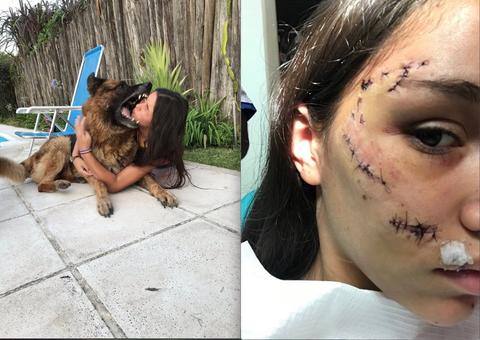 Cachorro morde rosto de jovem durante ensaio fotográfico  