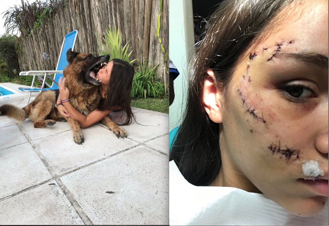 Cachorro morde rosto de jovem durante ensaio fotográfico  