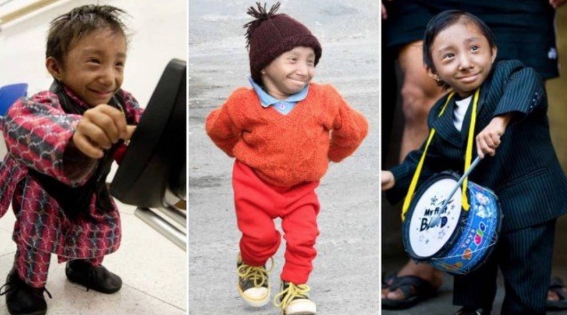 Menor homem do mundo morre aos 27 anos