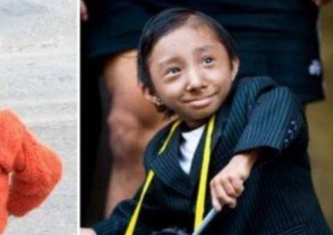 Menor homem do mundo morre aos 27 anos