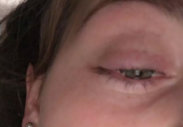Jovem quase perde a visão ao fazer extensão de cílios 