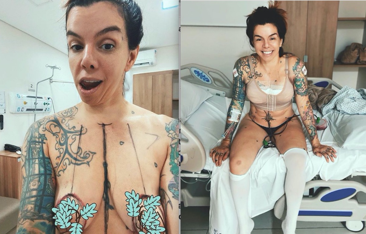 Penélope Nova comemora resultado de cirurgia nos seios