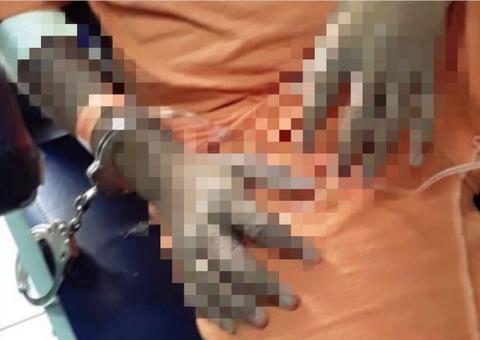 Detentos têm partes do corpo deformadas por bactérias em penitenciária