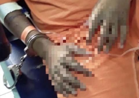 Após detentos terem corpos deformados por infecção, MP pede interdição de presídio