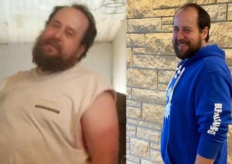 Pai emagrece 18 quilos para doar fígado e salvar a vida do filho