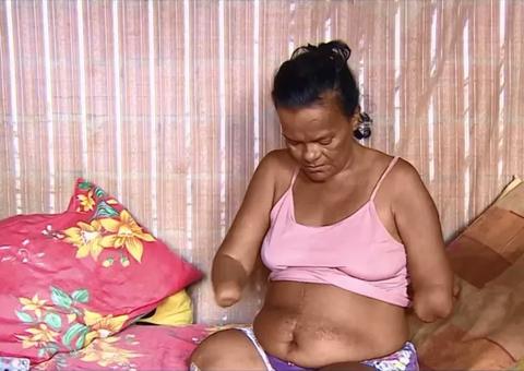 Mulher sem mãos e pernas tem pedido de benefício negado pelo INSS por não poder assinar papel