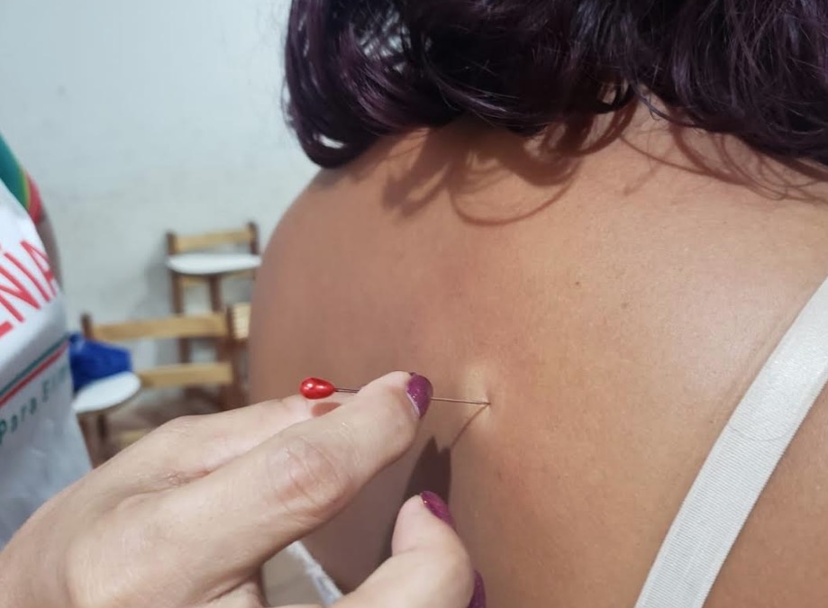 Policlínica realiza exames de diagnóstica da hanseníase em Manaus 