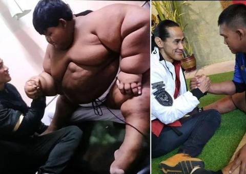 Menino mais gordo do mundo perde mais da metade do seu peso