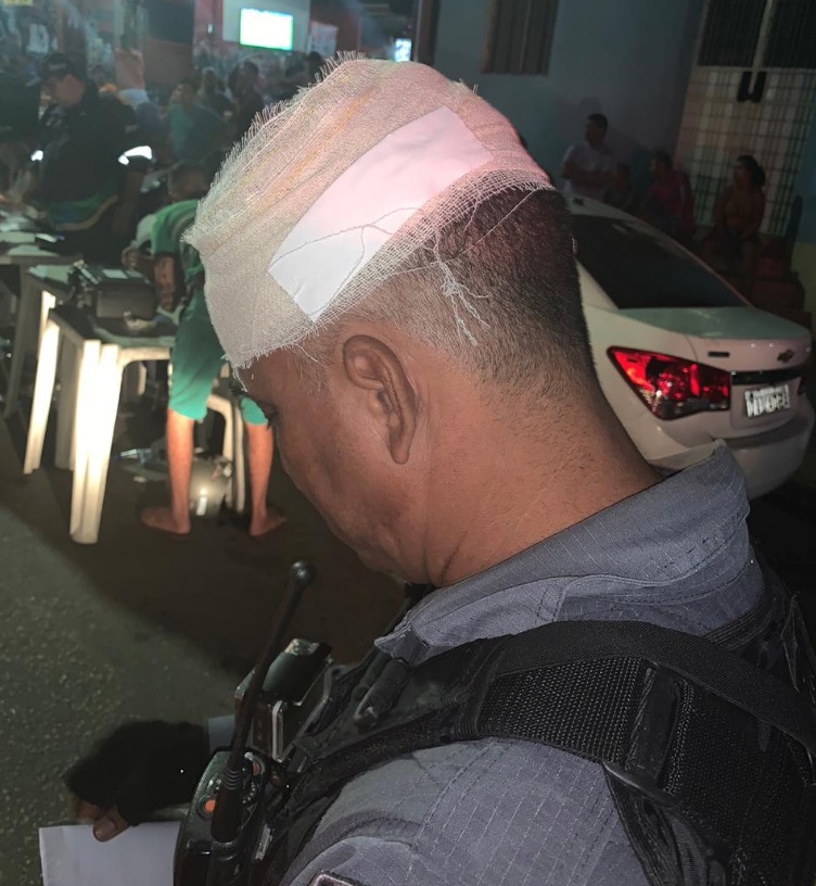 Motorista resiste à prisão e atinge cabeça de policial com garrafa de vidro em Manaus 